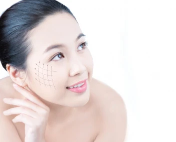Xóa nếp nhăn trên khuôn mặt để giữ gìn tuổi thanh xuân - ĐẤT VÀNG